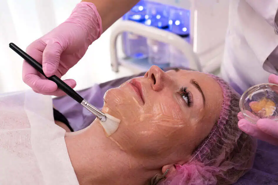 Chemical Peel by Bare Medical Aesthetics P.L.L.C in Greeley, CO