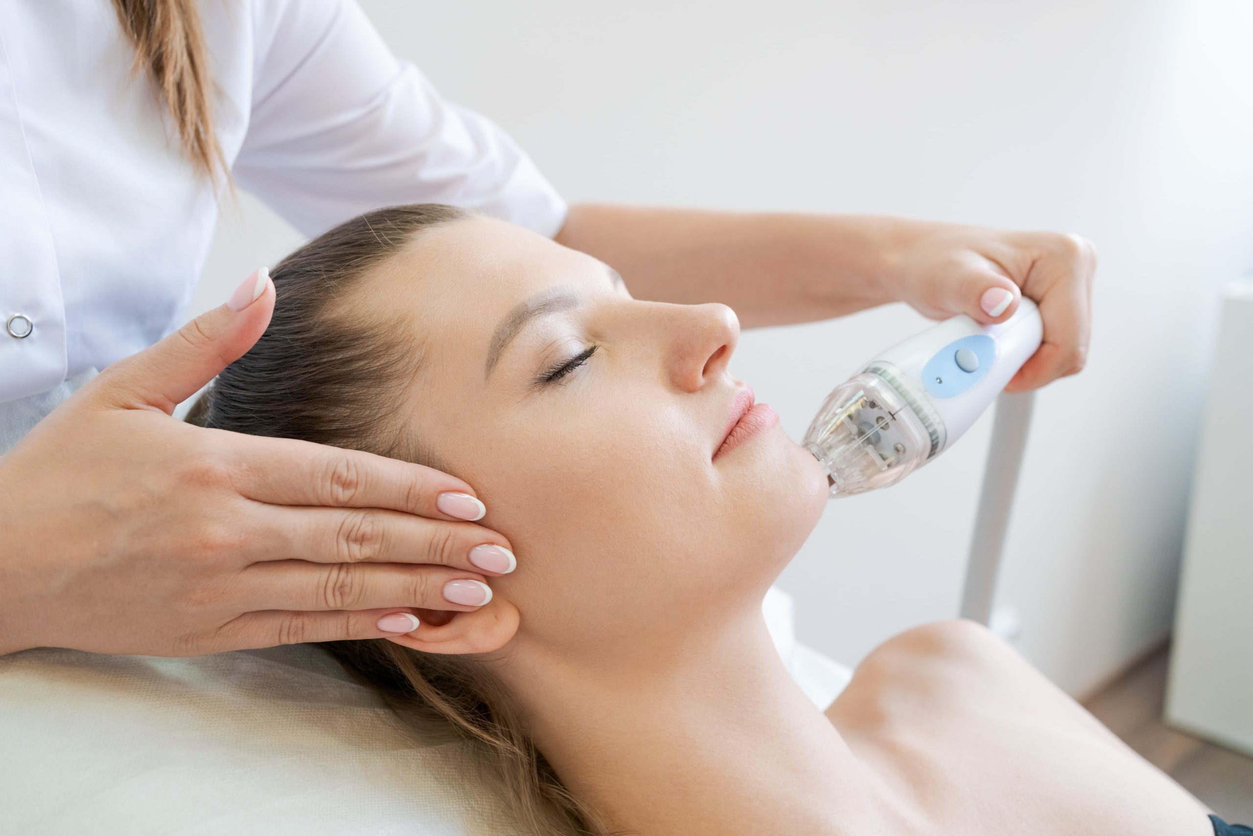 Radio Frequency (RF) Microneedling